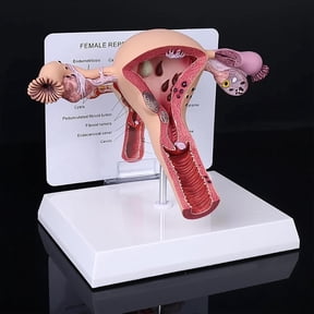 Pathological Uterus Ovary Model, Female Reproductive Organ Model Human Uterus Anatomical Model with Educational Display Card and Base, for Teaching Learning