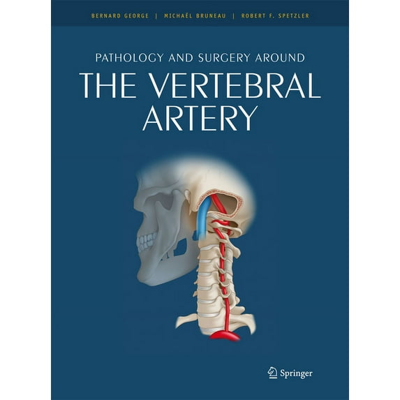 Pathology and Surgery Around the Vertebral Artery, (Hardcover)