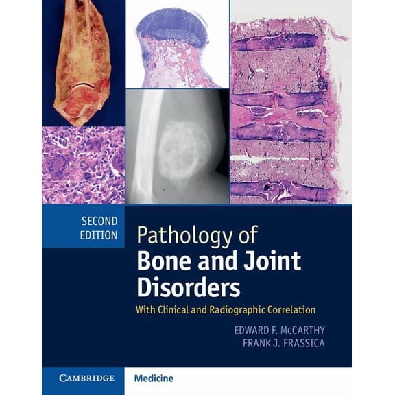 Pathology of Bone and Joint Disorders Print and Online Bundle: With Clinical and Radiographic Correlation, (Paperback)