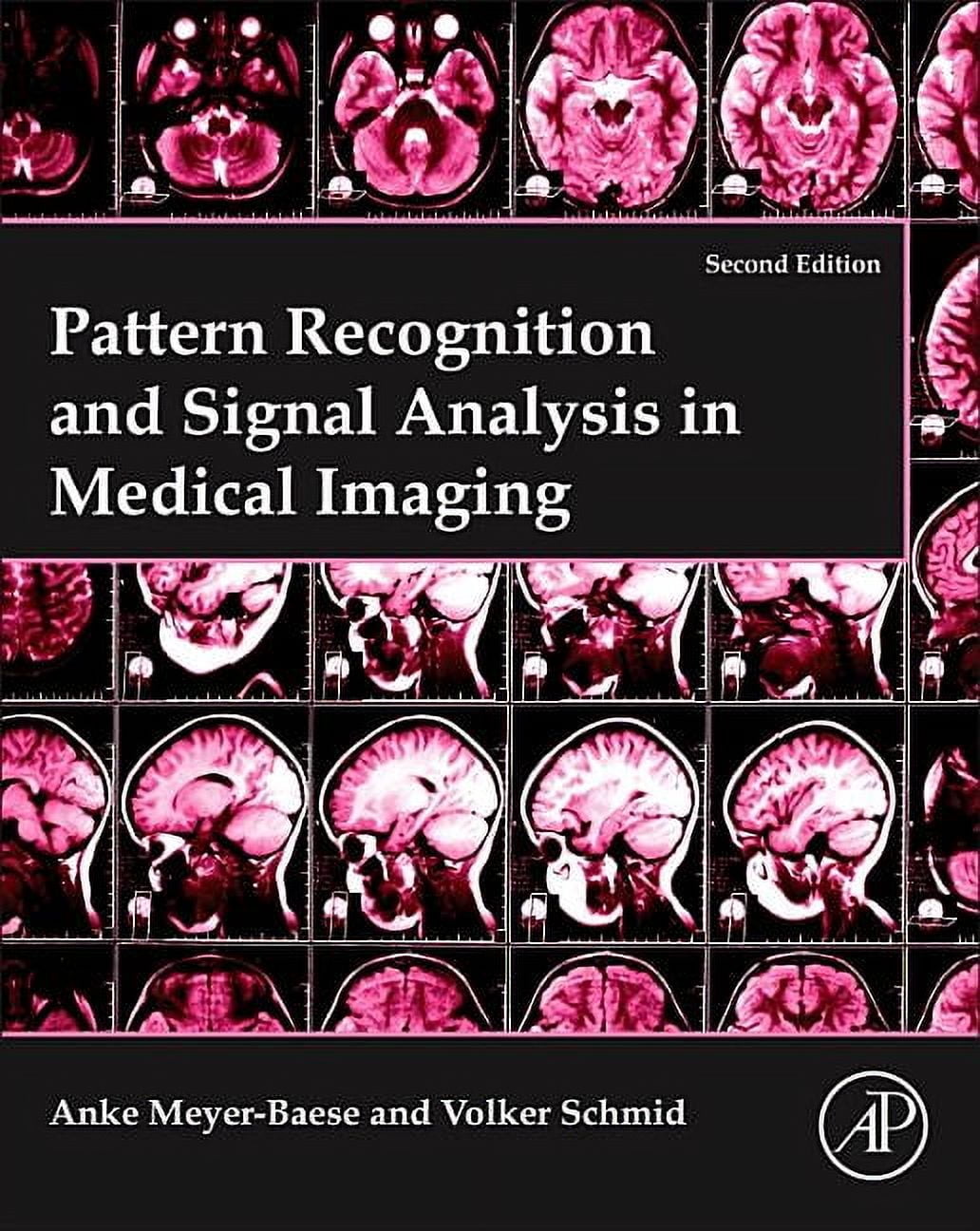Pattern Recognition and Signal Analysis in Medical Imaging (Paperback ...