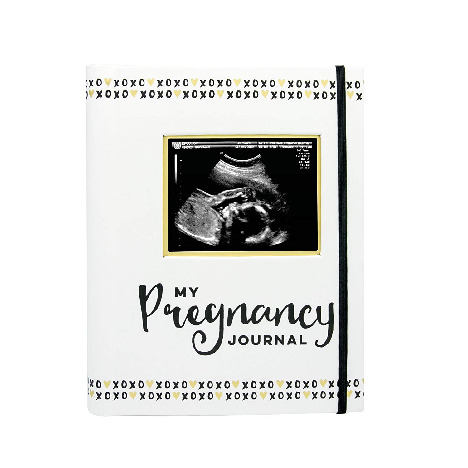 Pearhead My Pregnancy Journal Book, White, Gold and Black