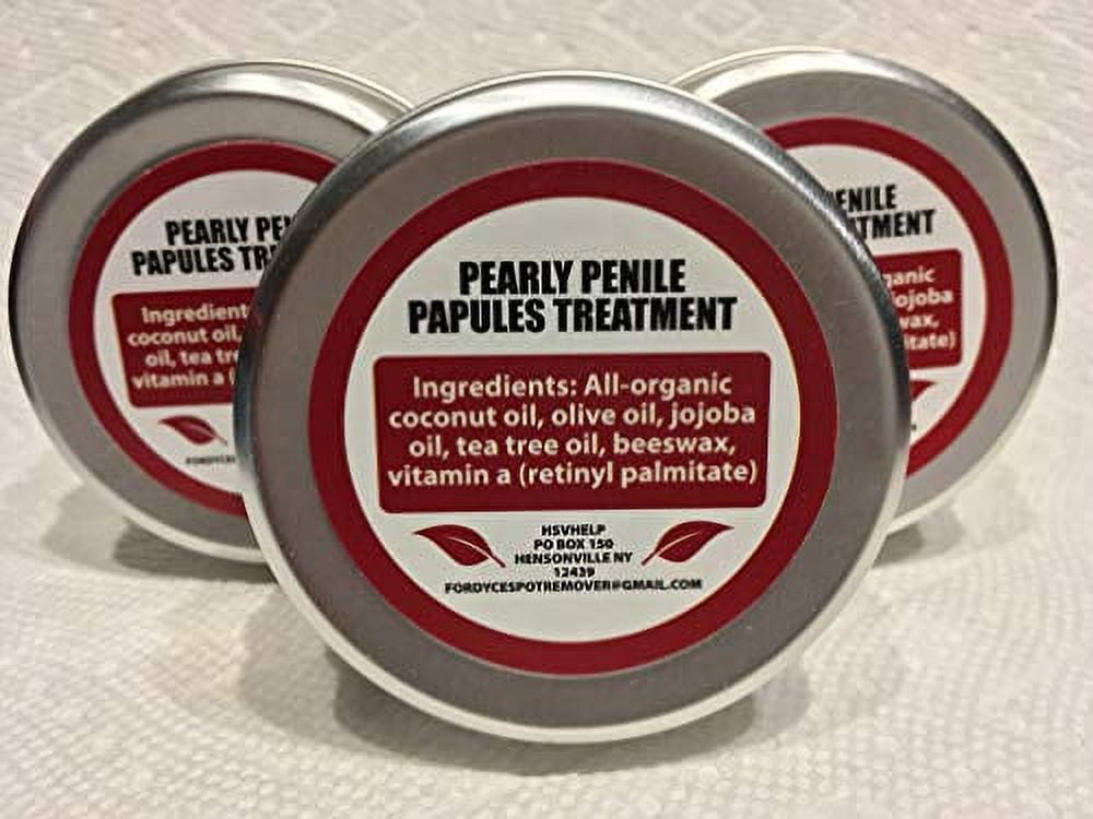 Pearly Penile Papules Removal Cream Fordyce Spots treatment for