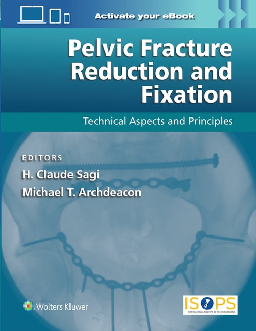 Pelvic Fracture Reduction and Fixation: Technical Aspects and Principles, (Hardcover)