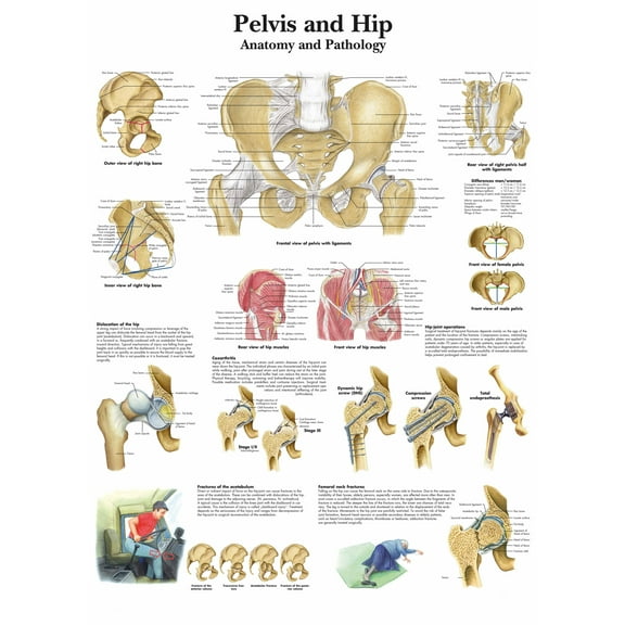 Pelvis and Hip  Anatomy and Pathology Wall Art Posters Canvas Print Artwork Wall Chart Human Anatomy Wall Painting Office Hospital Room Home Decoration (without Framed),Multicolor