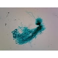 thumbnail image 1 of Penicillium; Section Showing Conidiophores with Conidia by Go Science Crazy, 1 of 1