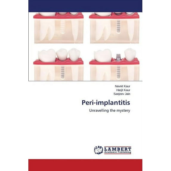Peri-implantitis, (Paperback)