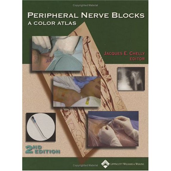 Pre-Owned Peripheral Nerve Blocks: A Color Atlas (Hardcover) 0781736404 9780781736404