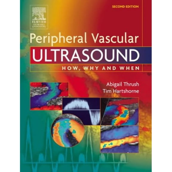Pre-Owned Peripheral Vascular Ultrasound: How, Why and When, 9780443072833, 0443072833, Hardcover, 2 edition
