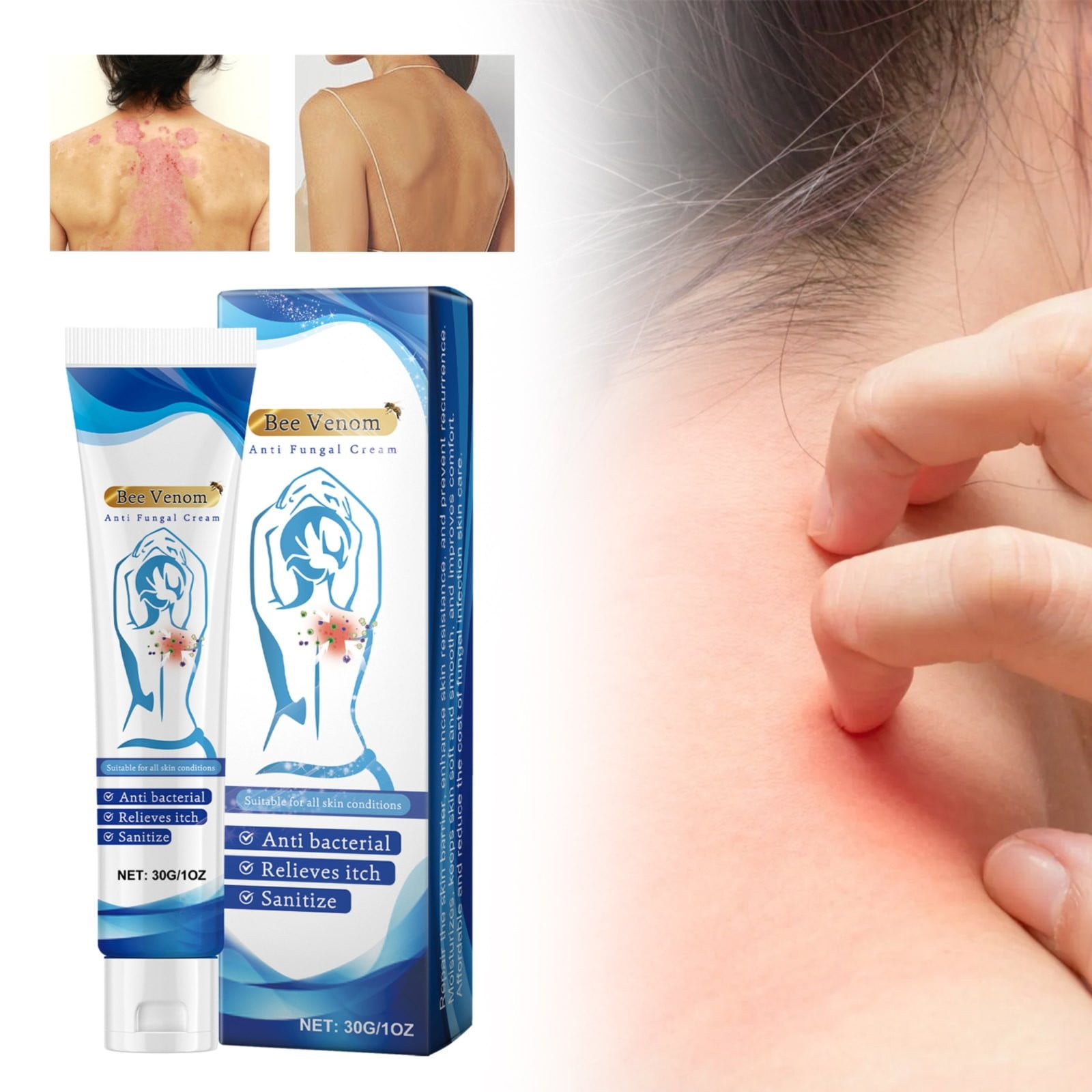 Personal Skin Care,Body Care For Eliminating Relieving Redness And