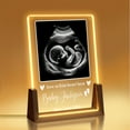 thumbnail image 1 of Personalized Ultrasound Picture Frame LED Night Light, Pregnancy Gift for New Moms To Be, Custom Acrylic Plaque with Sonogram Photo, Gender Neutral Love at First Sight Baby Keepsake Nursery Decor, 1 of 8