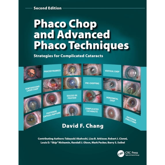 Phaco Chop and Advanced Phaco Techniques: Strategies for Complicated Cataracts, (Paperback)
