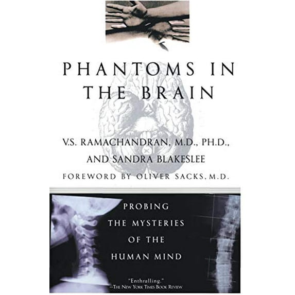 Pre-Owned Phantoms in the Brain (Paperback) 0688172172 9780688172176