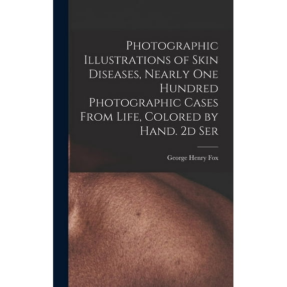 Photographic Illustrations of Skin Diseases, Nearly One Hundred Photographic Cases From Life, Colored by Hand. 2d Ser (Hardcover)