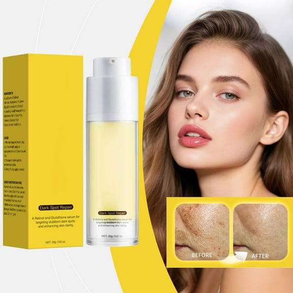 PiGOGI Dark Spots Light Cream with Retinol & Glutathione, Dermatologist formulated for Discoloration, 30g