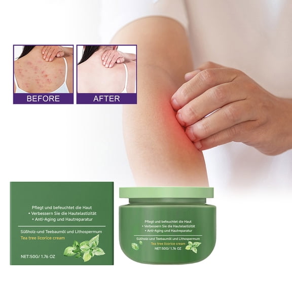 PiGOGI Tea Tree Licorice Cream, Nourishing Herbal Anti Itching, Moisturizes and Cares Skin, 50g, for Body Use