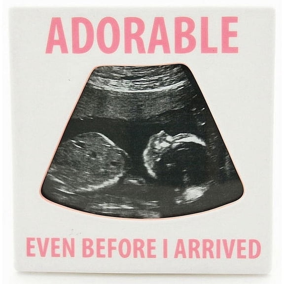 Pink ADORABLE   Ultrasound frame by Our Name is Mud - 3.250x4