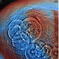 thumbnail image 1 of Pink Floyd - Meddle, 1 of 3