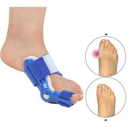 Pinkiou 1 Pair Toe Separator Bunion Splint Brace Big Toe Straightener Guard Orthopedic Tool for Hammertoe Hallux Valgus Blue