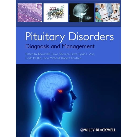 Pituitary Disorders, (Paperback)
