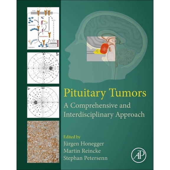 Pituitary Tumors: A Comprehensive and Interdisciplinary Approach, (Hardcover)