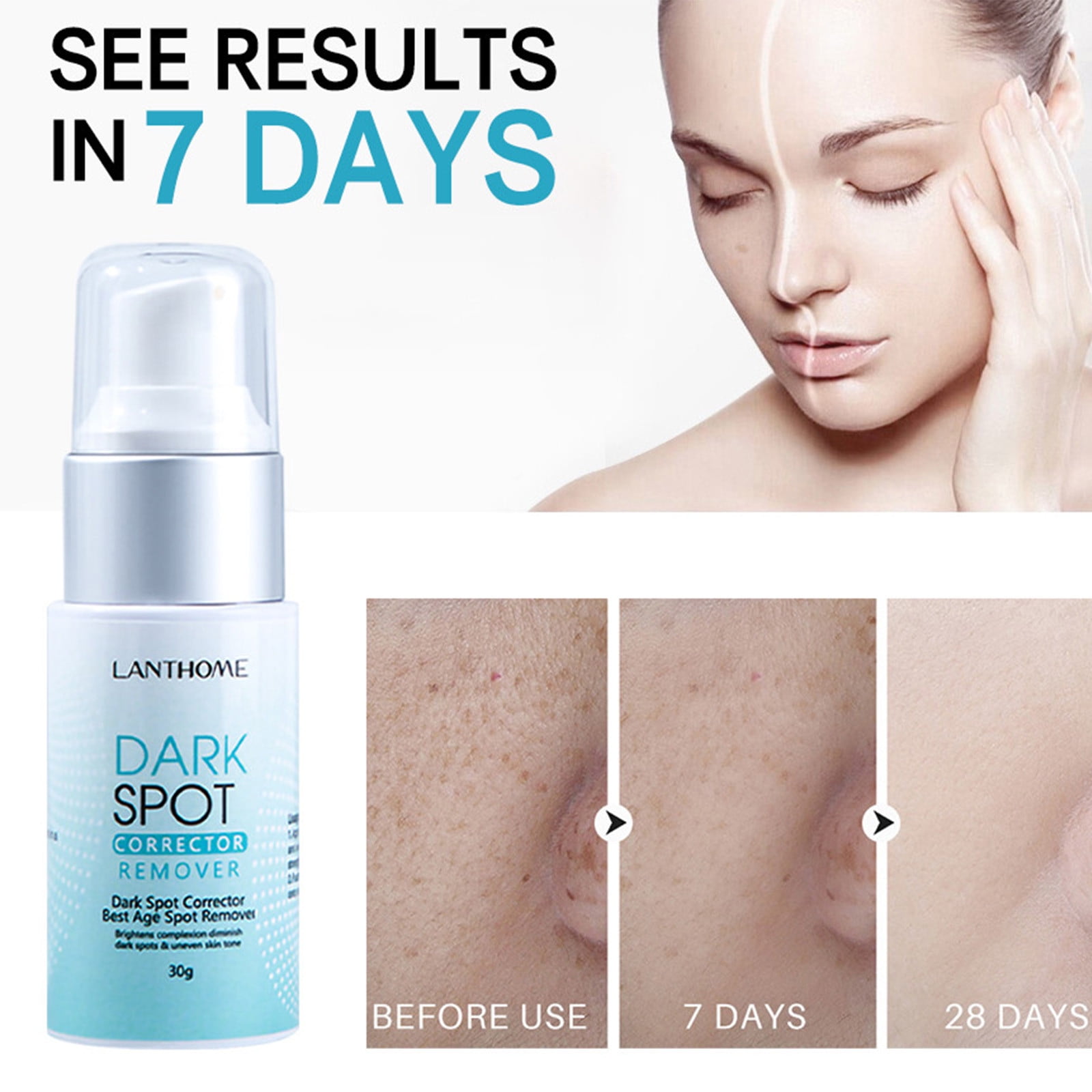 Pklyzj Dark Spots Corrector for Face and Body, Dark Spots Corrector