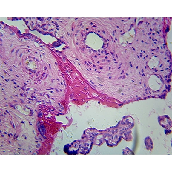 Placenta, Human; Showing Chorionic Villi; Section by Go Science Crazy
