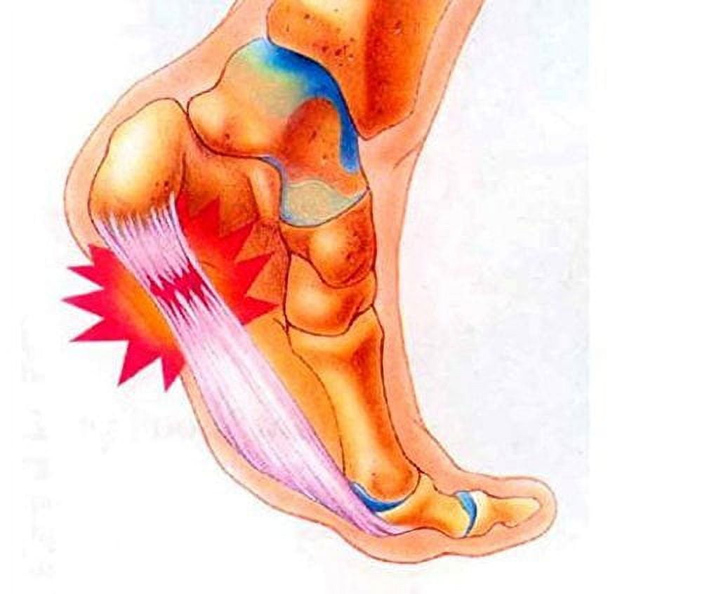 Plantar Fasciitis Therapy Wrap Plantar Fasciitis Arch Support
