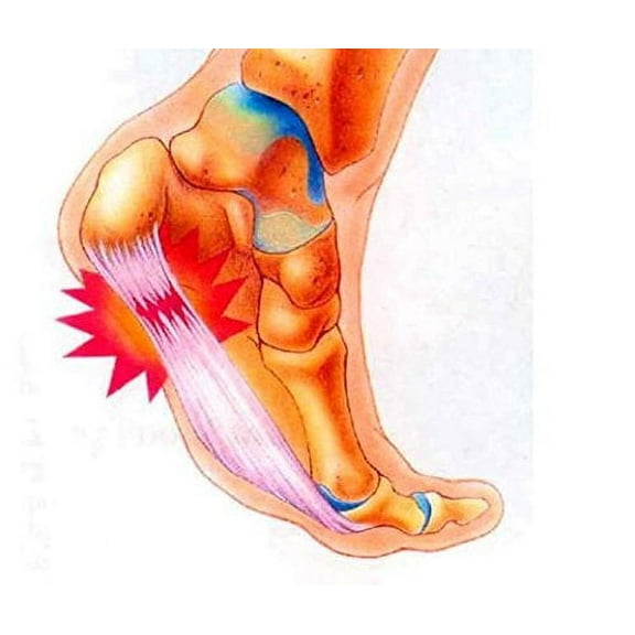 Plantar Fasciitis Therapy Wrap - Plantar Fasciitis Arch Support, Relieve Plantar Fasciitis, Heel Pain, Arch Support, Plantar Fasciitis Sock - Brown or Tan