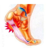 plantar fasciitis therapy wrap - plantar fasciitis arch support, relieve plantar fasciitis, heel pain, arch support, plantar fasciitis sock - brown or tan