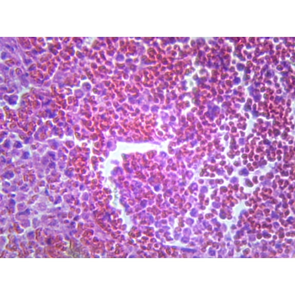 Pneumonia (Human Respiratory System); Section; H&E Stain by Go Science Crazy