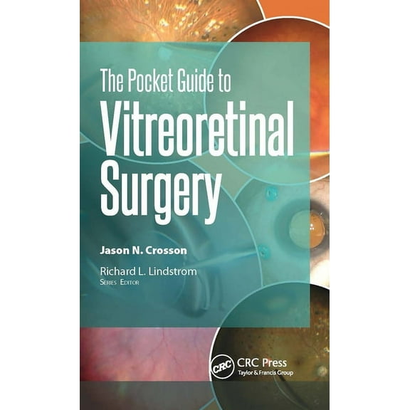 Pocket Guides The Pocket Guide to Vitreoretinal Surgery, (Paperback)