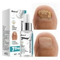 Polish Thinner For Thinning Out Clumped Up and Hardened Nail Paint