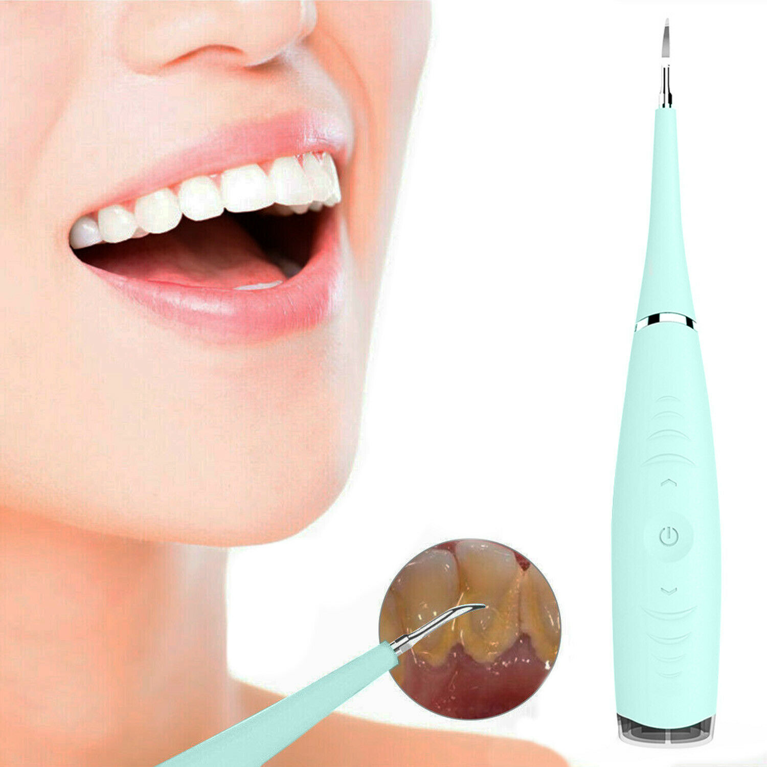 Portable Electric Sonic Dental Scaler Tooth Calculus Remove Tooth Wihtening Tool Green - image 1 of 6