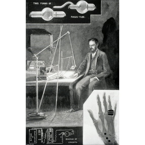 Posterazzi DPI1861640LARGE The New Photography or X Ray Photography From the Modern Cyclopedia Vol Vi 1903 Poster Print, 22 x 36