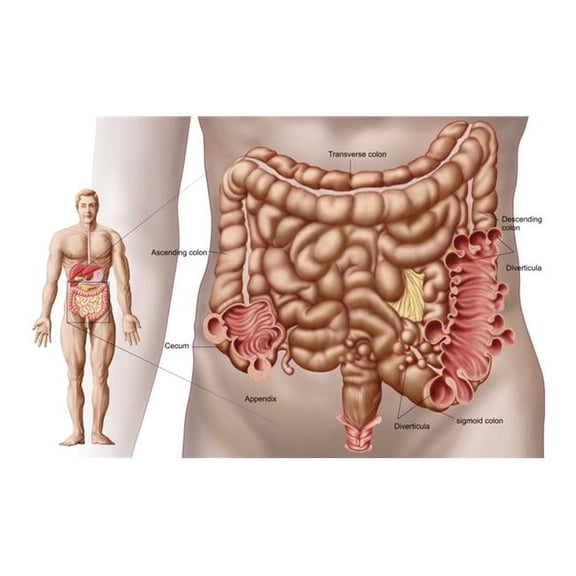 Posterazzi Human Intestine 18 x 10 Y Poster Print