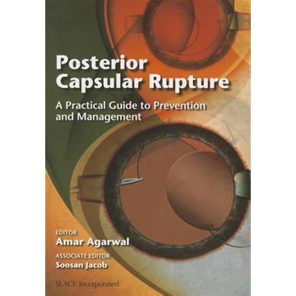 Pre-Owned Posterior Capsular Rupture: A Practical Guide to Prevention and Management, (Paperback)