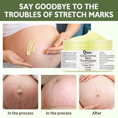 Postpartum Elegance Natural Deep Stretch Mark Removal Cream for Pregnancy - Scar Repair, Abdominal Firming, and Gentle Stretch Mark Eradication