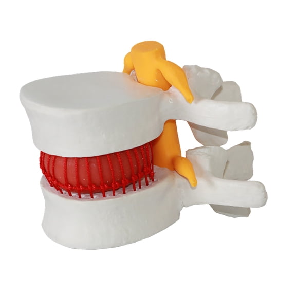 Pouches For Organization Disc A Model Dentals Anatomy Prolapse Medicals Anatomical Lumbar Office & Stationery