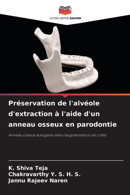 PrÃ©servation de l'alvÃ©ole d'extraction Ã l'aide d'un anneau osseux en ...