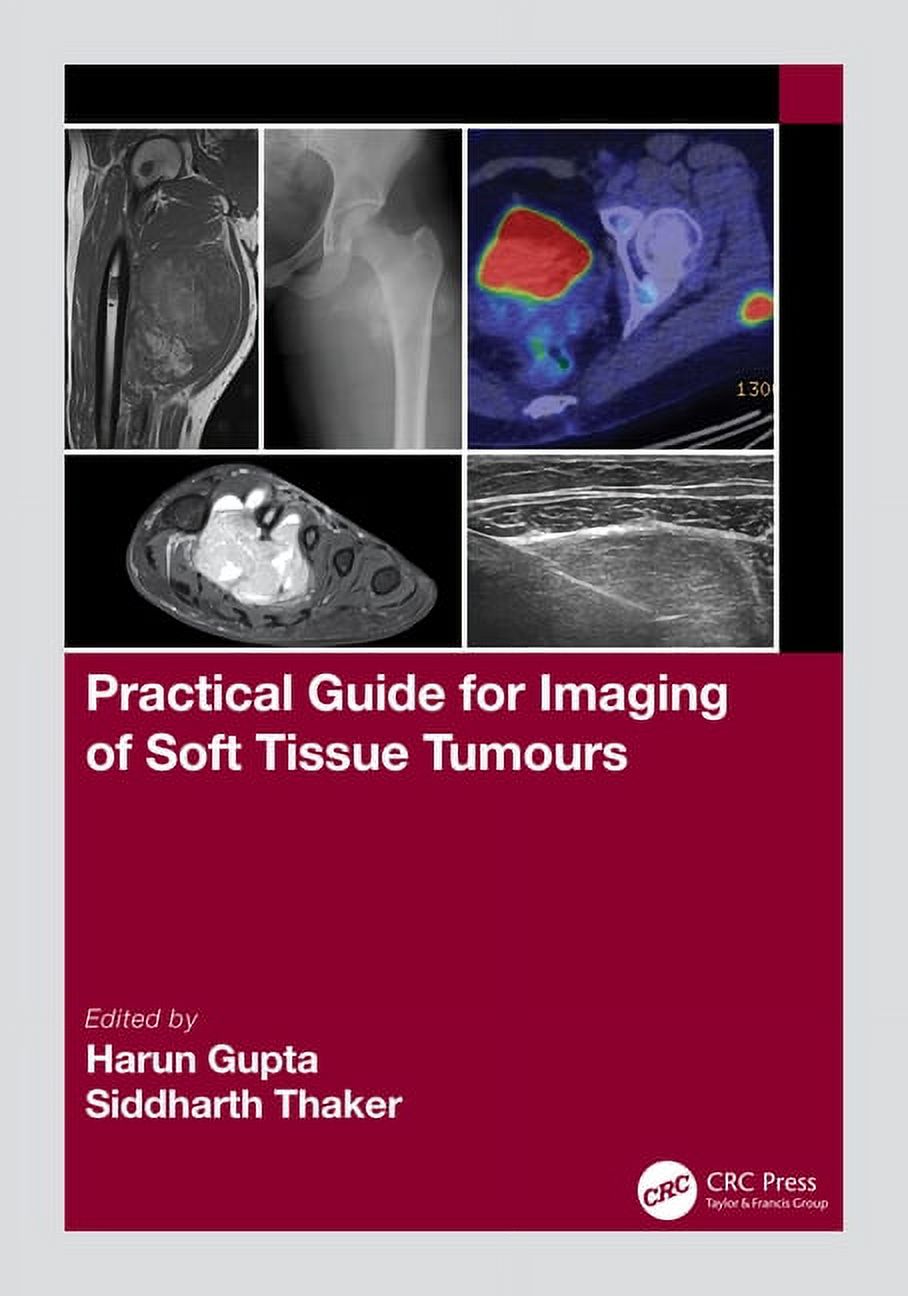 Practical Guide for Imaging of Soft Tissue Tumours - Walmart.com
