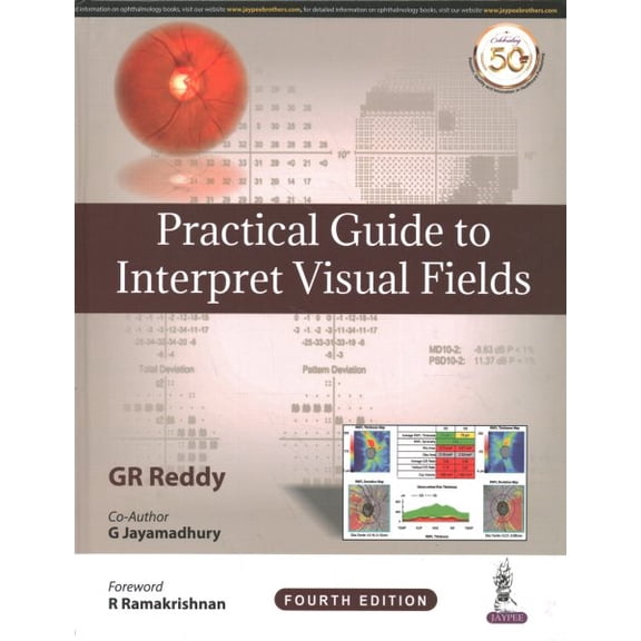 Practical Guide to Interpret Visual Fields