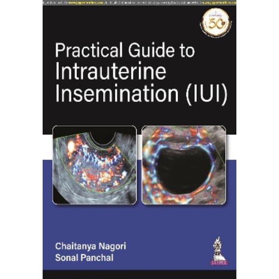 Practical Guide to Intrauterine Insemination (IUI) Chaitanya Nagori,Sonal Panchal (Paperback)