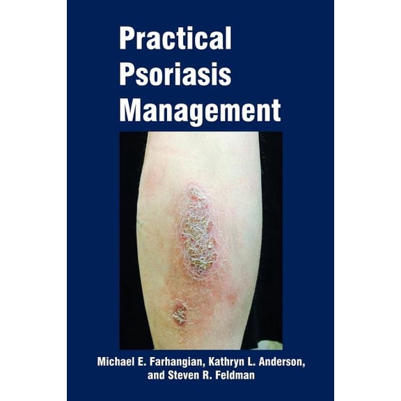 Practical Psoriasis Management (Paperback)