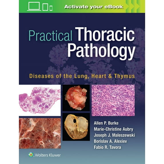 Practical Thoracic Pathology: Diseases of the Lung, Heart, and Thymus, (Hardcover)