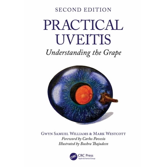 Practical Uveitis: Understanding the Grape, (Paperback)