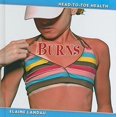 thumbnail image 1 of Pre-Owned Burns (Hardcover) 9780761448327, 1 of 1
