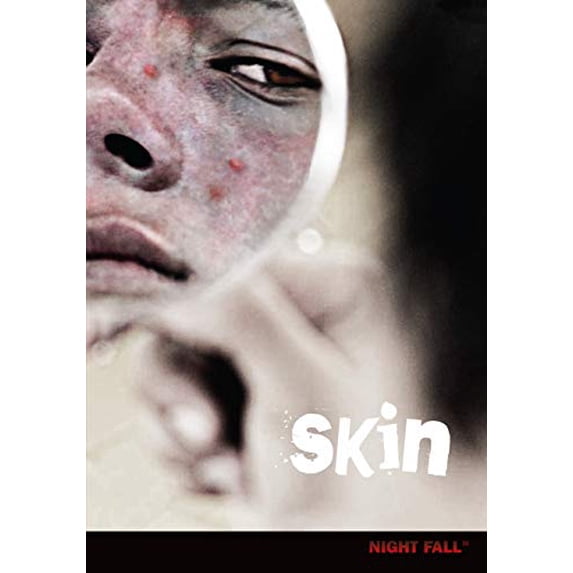Pre-Owned Skin (Paperback) 0761361588 9780761361589