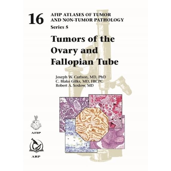 Pre-Owned Tumors of the Ovary and Fallopian Tube (AFIP Atlas of Tumor and Non-Tumor Pathology, Series 5, 16) Hardcover