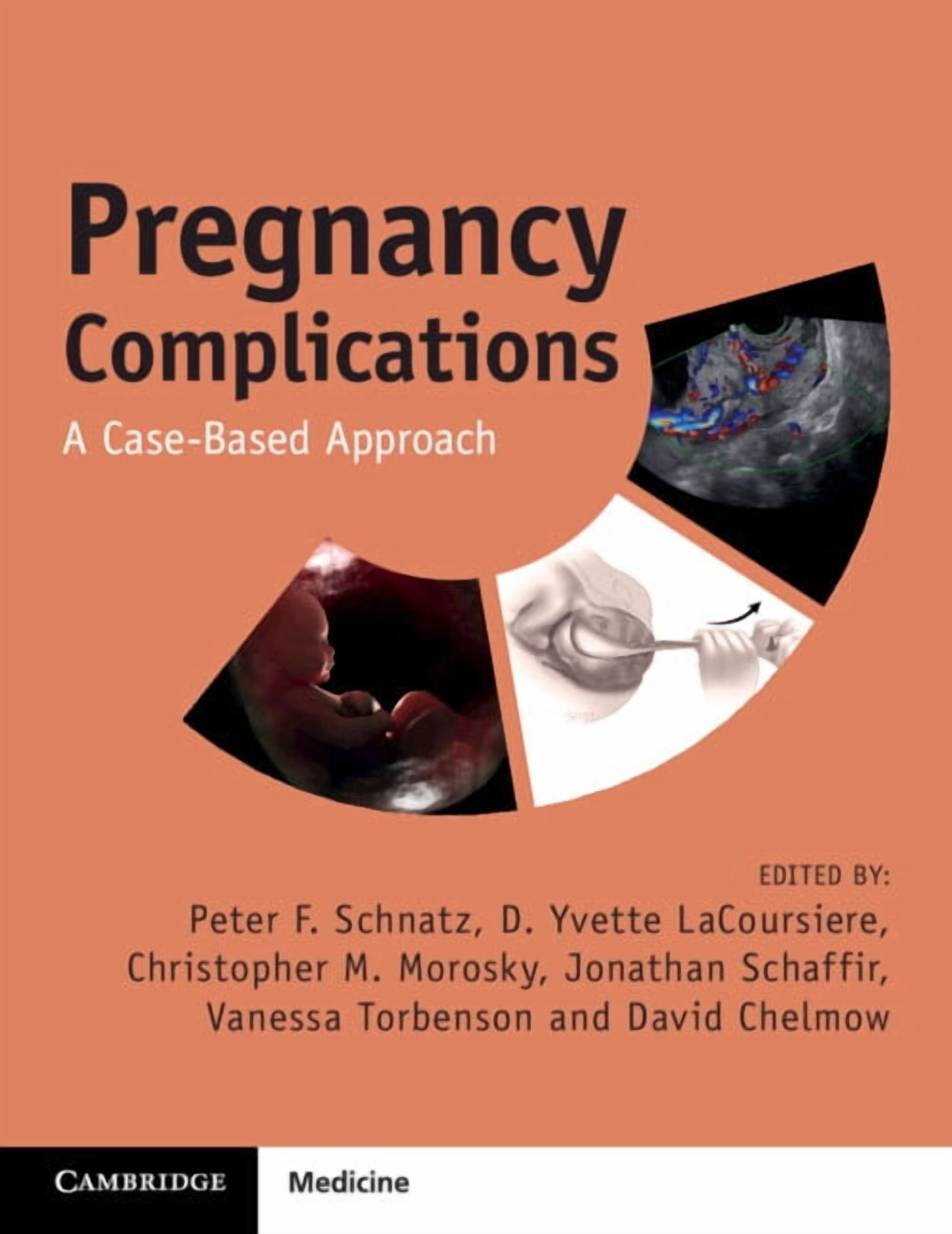 Pregnancy Complications: A Case-Based Approach, (Paperback)