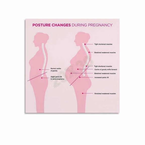 Pregnancy Posture Changes Poster Childbirth Education Wall Art (1) Canvas for Living Room Bedroom Decor
